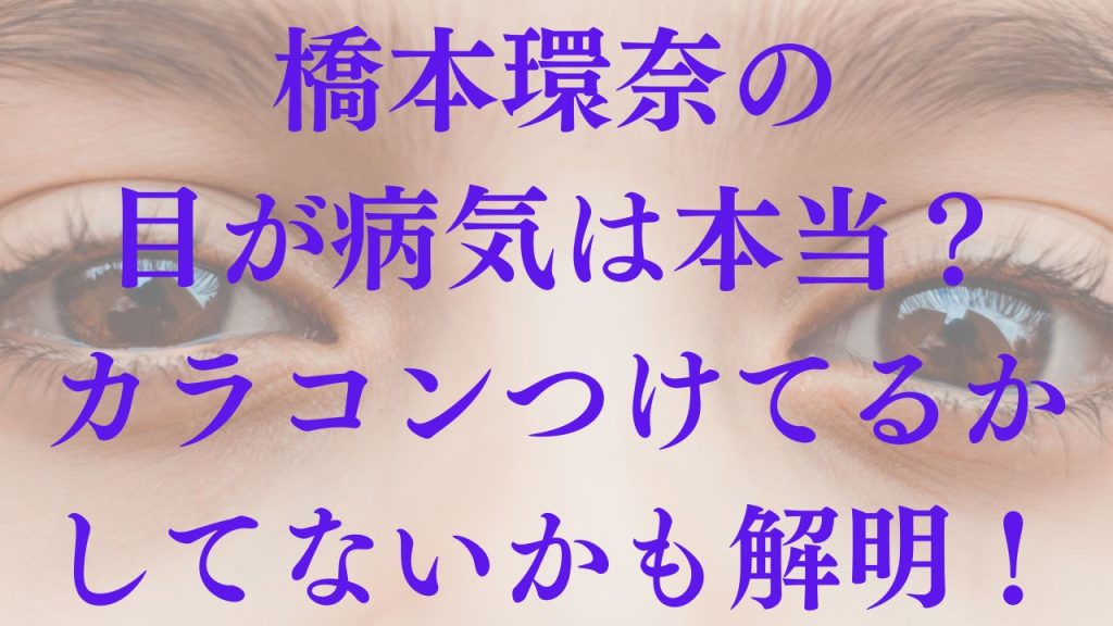 橋本環奈の目が病気は本当？カラコンつけてるかしてないかも解明！